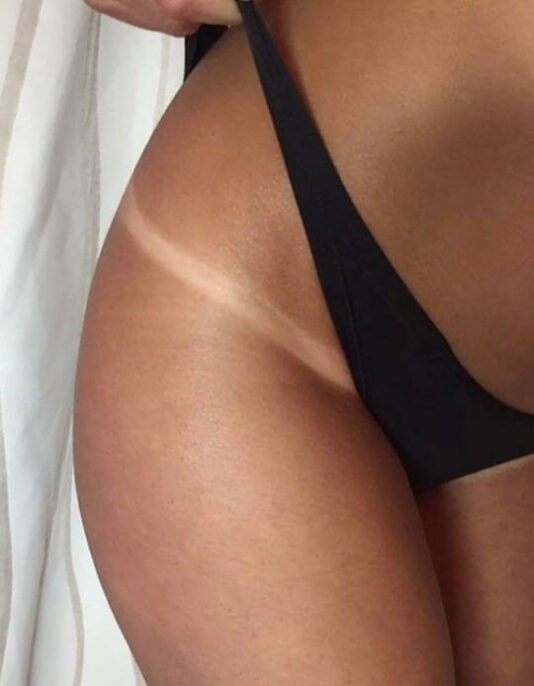 tan lines dark