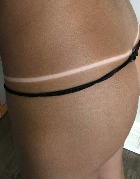 violet tan lines